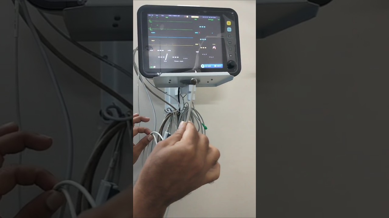 PATIENT MONITOR ME PATIENT KA TEMPERATURE KAISE DEKHE