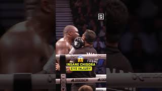 Derek Chisora nearly lost his vision in CRAZY round 3 with Deontay Wilder