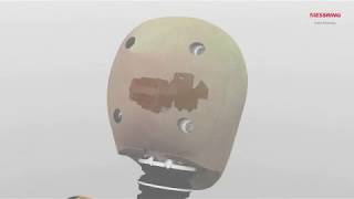 M=BUS InDummy Sensors from MESSRING integrated in a Child Dummy Q3.