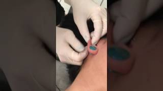 Faux Snug Piercings - interesting ear anatomy