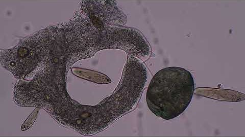 Amoeba hunts and kills paramecia and stentor to music by Lamar Genesis Winter Zimmeryoutube com