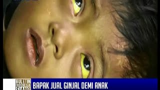 Seorang Ayah Ingin Jual Ginjal Ke Presiden Jokowi Untuk Biaya Operasi Anaknya - BIS 19/11