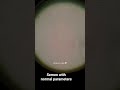 #semen #embryologist #embryology #sperm #spermcountincrease #spermanalysis