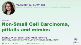 #PULMPATH Non-Small Cell Carcinoma, Pitfalls and Mimics