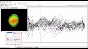 EMSE Quick Video - Imaginary Coherency and Hilbert Transform