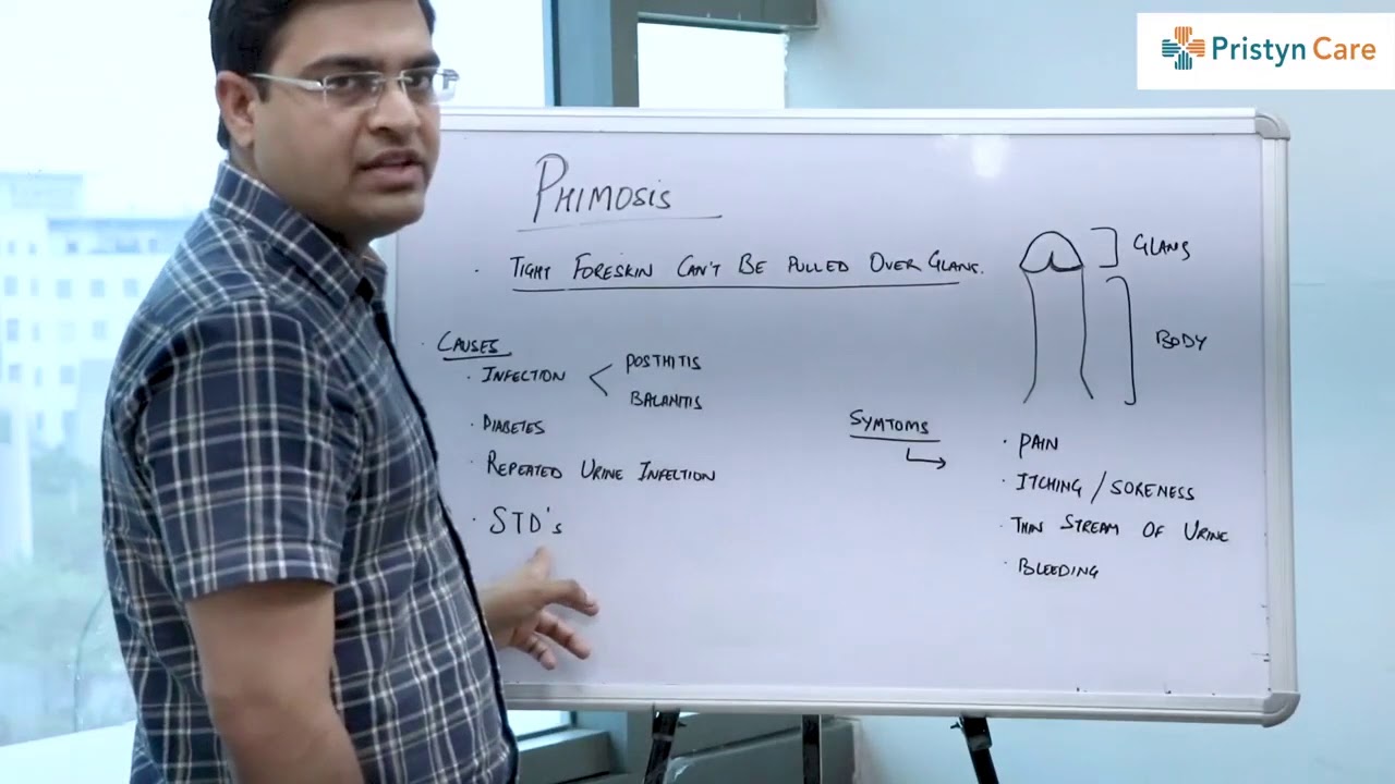 What is Circumcision | Benefits of Laser Circumcision | Book FREE Appointment 📞9211990265