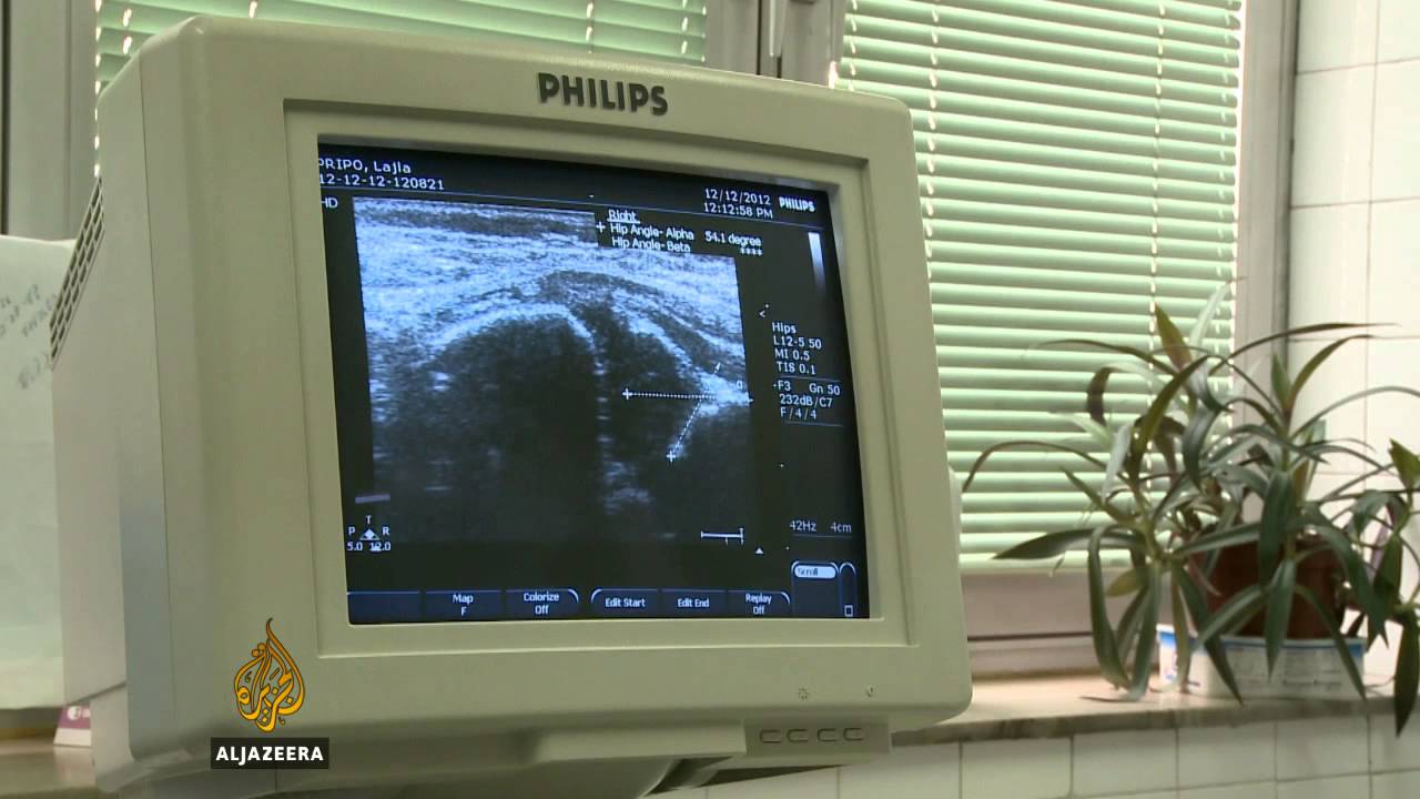 تحذير من إضراب العاملين في القطاع الصحي في اتحاد البوسنة والهرسك - قناة الجزيرة البلقان
