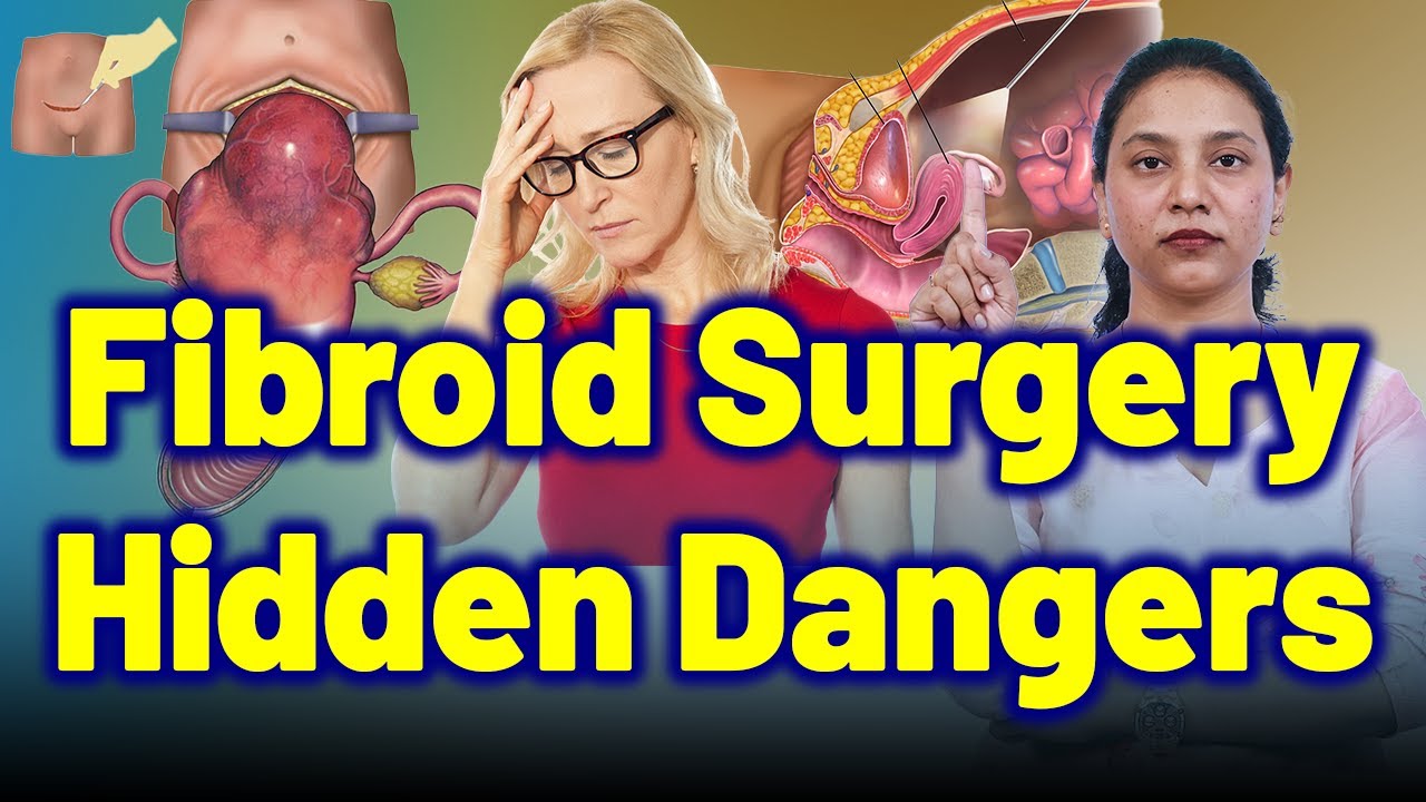 Is Fibroid Surgery Safe? Uncovering the Hidden Complications. |Treatment & Cure | Homeopathy,