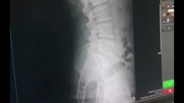 Carestream Directview CR Digital X-Ray System