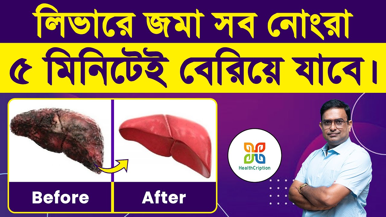 Liver Detox Naturally | লিভারে জমা সব নোংরা পাঁচ মিনিটেই বেরিয়ে যাবে। Fatty Liver Prevention. 