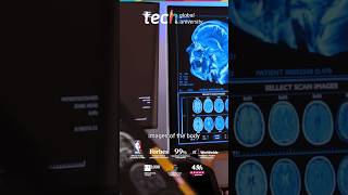 Computed Tomography: Functioning and Image Reconstruction
