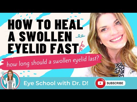 Video: 3 manieren om een gezwollen ooglid te genezen