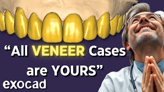 Make Clients go CRAZY. VENEER Premium EXOCAD