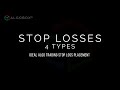 Lesson #58 🔴 4 Types of Stop Losses
