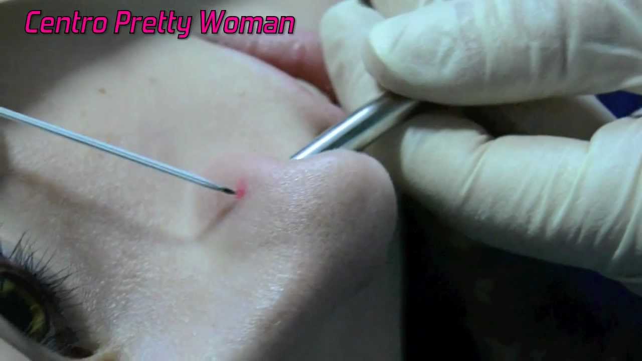 duele mucho piercing nariz