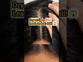 Hair Fall Started Like This 😱 Stop This Mistake Now🧿🎀#shorts #haircare #fypシ゚viral #ytshorts #hair