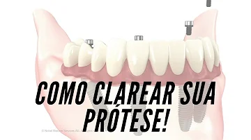 Como fazer para tirar o amarelado da dentadura?