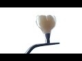 Імплантація Зубів 🦷 Поставимо Всі Крапки над "і" ~ Дентальная Имплантация Зубов под Ключ