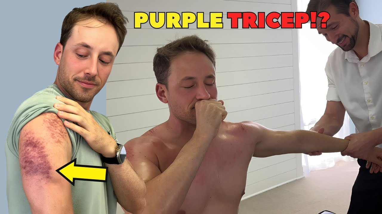 Making A Grown Man CRY?!? 😭 The WORST PURPLE Bruising on Man's TRICEP...Crunchy - Daily Vlog