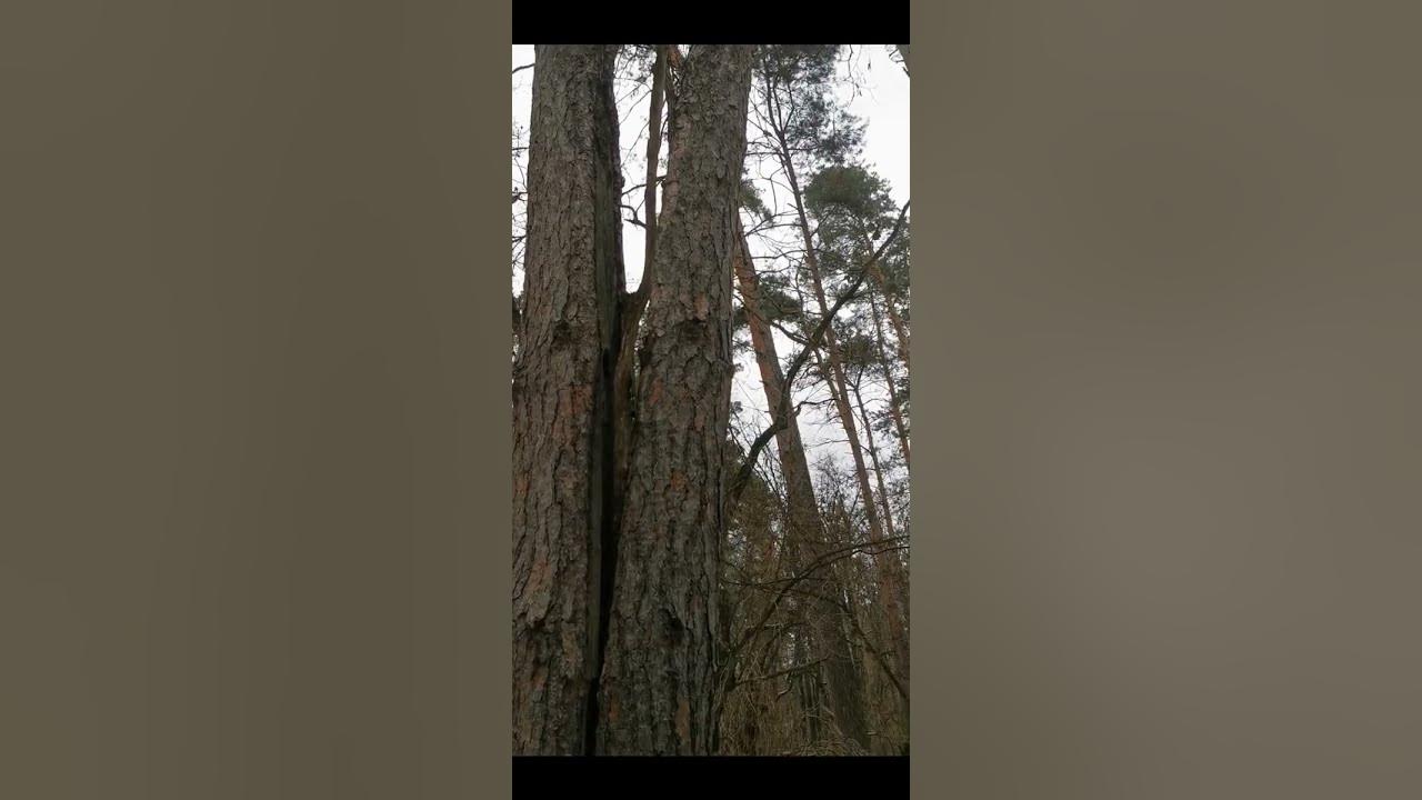 Сіамські близнюки. - YouTube