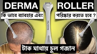 How to use Derma Roller for Hair Regrowth ? Derma Roller দিয়ে টাক মাথায় কি ভাবে চুল গজাবে ?