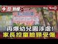 再爆幼兒園涉虐! 家長控童臉頸受傷｜TVBS新聞 @TVBSNEWS01