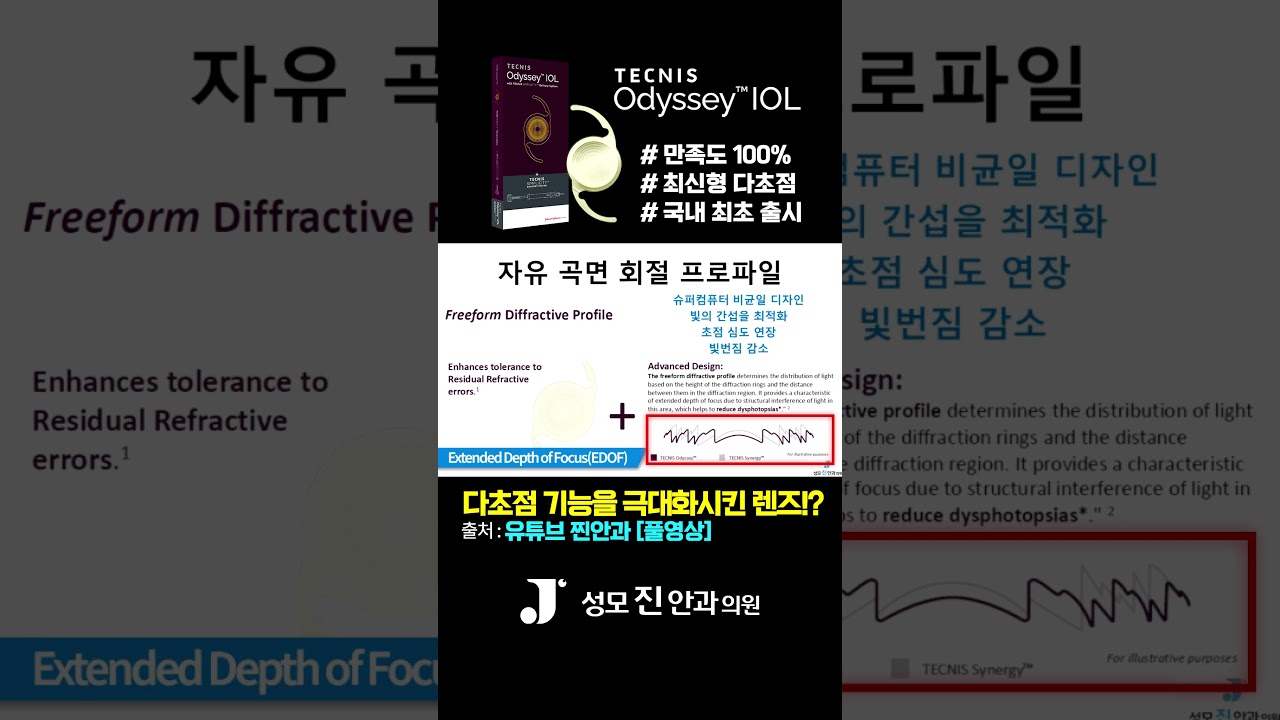 [Сонгможин Нүдний Эмнэлэг] Олон фокуст функцийг дээд зэргээр нэмэгдүүлэхээр бүтээгдсэн линз үү?! #СонгможинНүднийЭмнэлэг #КаннамНүднийЭмнэлэг #ЖинНүднийЭмнэлэг