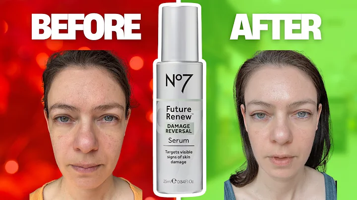 Boots No7 Future Renew 4-Week Review – Worth the Hype?
