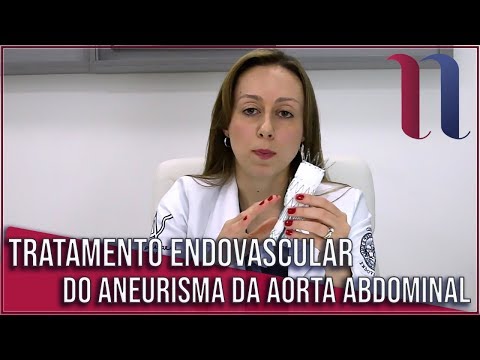 Vídeo: Aneurisma Da Aorta Abdominal - Sintomas, Tratamento, Cirurgia, Ruptura