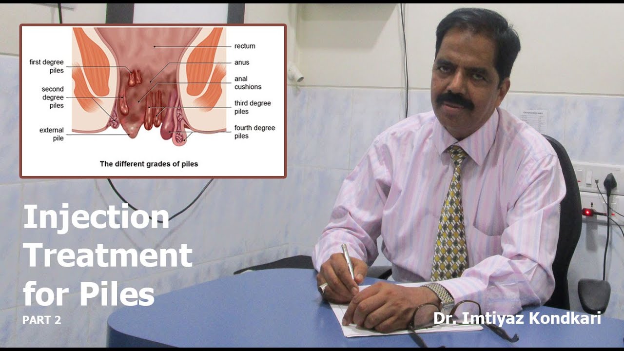 Injection Treatment for Piles Part 2 YouTube