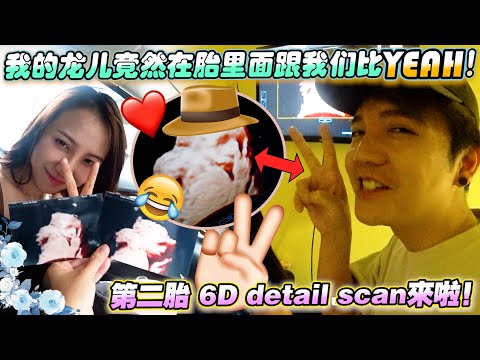 我的龙儿竟然在胎里面跟我们比yeah！！感觉很像Tara～第二胎detail scan来啦！