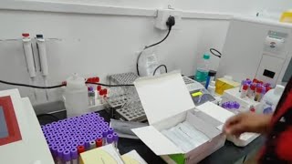  (TSH,T3,T4) Thyroid stimulating hormone profile test .sd biosensor F200 