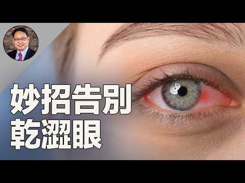 ????️眼睛乾澀怎麼辦？簡單中西醫方法，讓你輕鬆護眼！ ✨