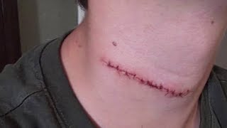 Daytona Beach police review handling of suspect in teen slashing case
