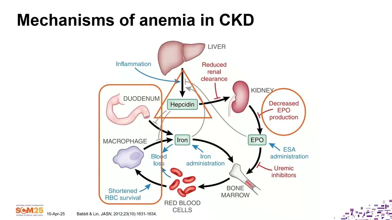 2025 Spring Clinical Meetings — From Research to Practice HIF PH Inhibitors for Anemia Management in