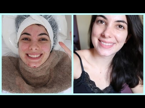 Update do meu tratamento de pele e hormonal! 🌸🌼