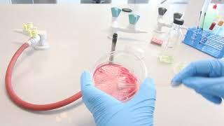 SWABBING ONTO PLATE: SWAB GENTLY ONTO AGAR SURFACE. TURN COTTON SWAB AS YOU APPLY IT ONTO AGAR.