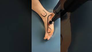 Myofascial trigger point 1 - Great for PLANTAR FASCIITIS.