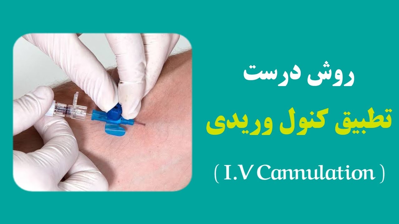 روش درست تطبیق کنول وریدی به زبان ساده | Venous Access Made Easy Adult ...