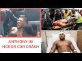 Anthony Joshua Seriously Injured in Car Accident Following Jake Paul Fight