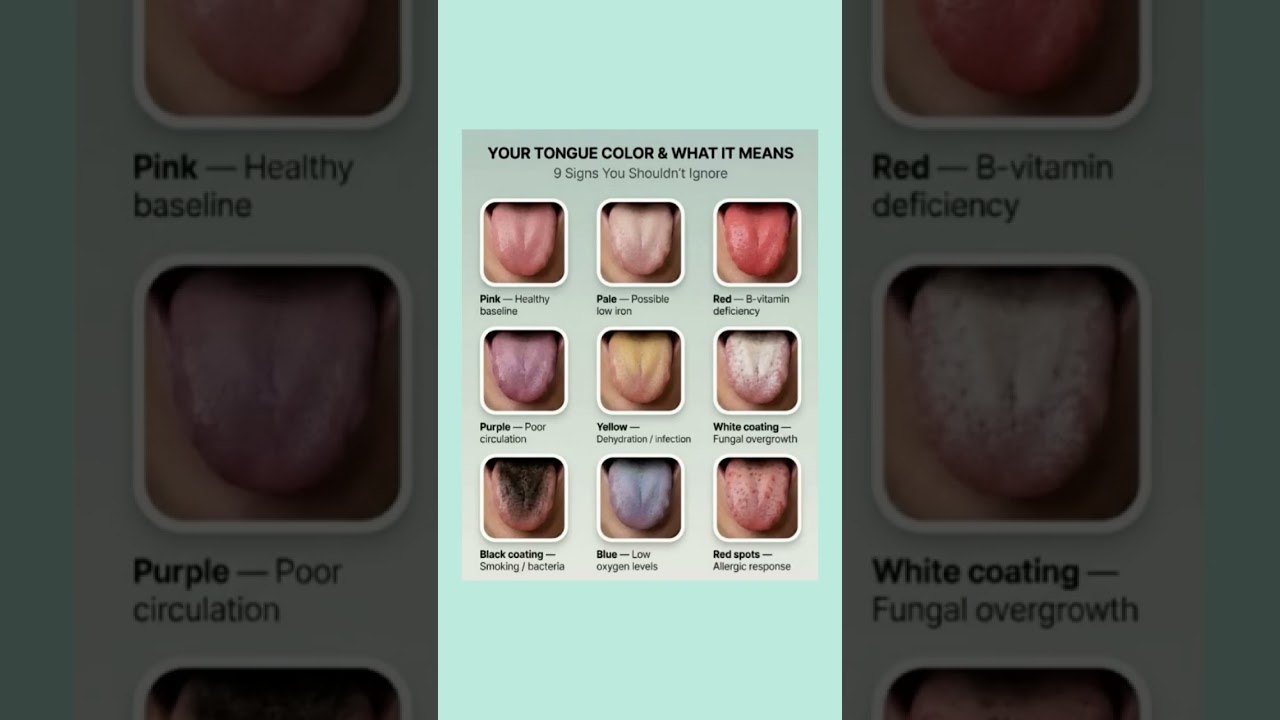 What Your Tongue Color Says About Your Health 👅 | 9 Signs You Shouldn’t Ignore