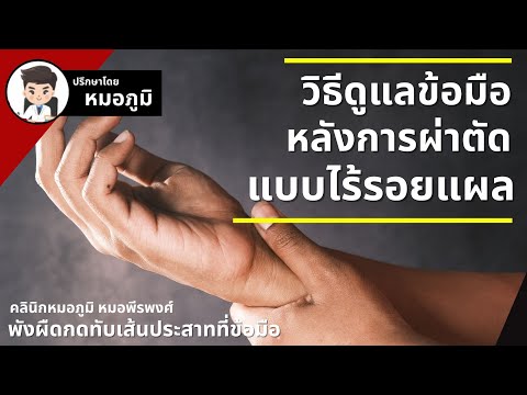 วีดีโอ: วิธีออกกำลังกายหลังการผ่าตัด Carpal Tunnel: แผนพักฟื้น 3 สัปดาห์