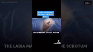 Gender reassignment surgery from female to male