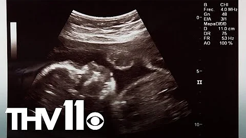 Near-total abortion ban signed into law by Gov. Hutchinson