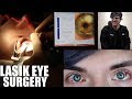 My Lasik Eye Surgery Experience! *LIVE FOOTAGE* | LasikPlus