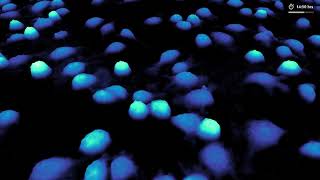 Wound Healing Ay - Cells Are Closing In Study Cell Migration Holomonitor