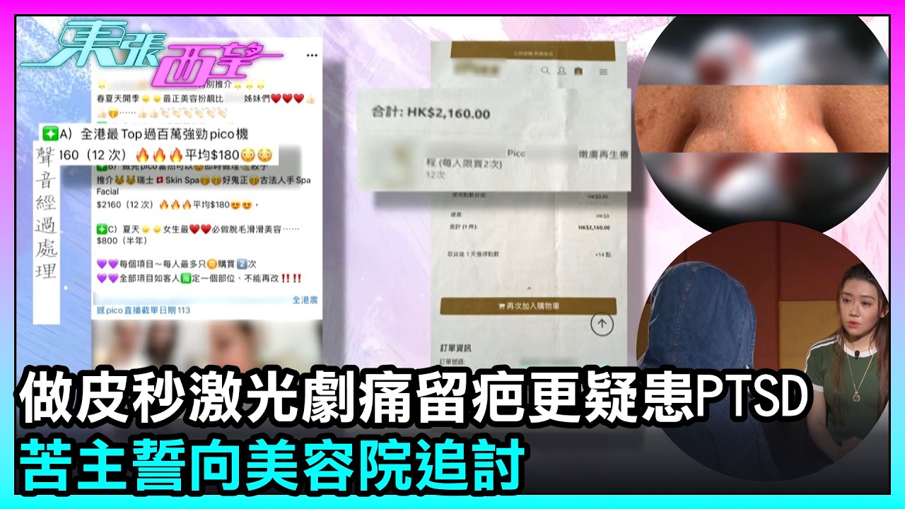 東張西望｜做皮秒激光劇痛留疤更疑患PTSD　苦主誓向美容院追討｜TVBUSA｜民生
