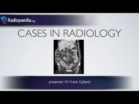 Cases in Radiology: Episode 2 (abdomen, CT)