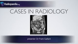 Cases in Radiology: Episode 2 (abdomen, CT)