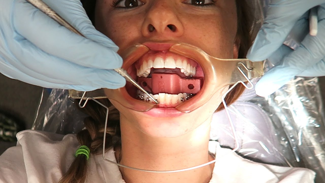 vlogs in spanish I GOT BRACES! 🤐